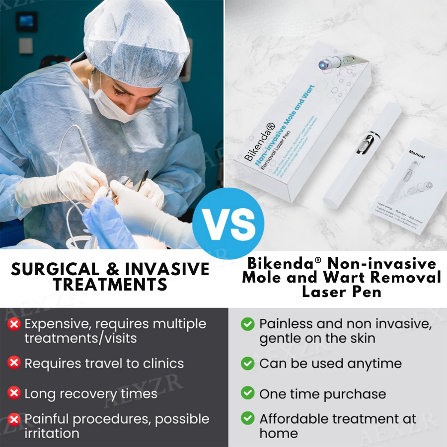 Bikenda® Non-Invasive Mole and Wart Removal Laser Pen