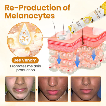 Oveallgo® Bee Venom Calm Cream