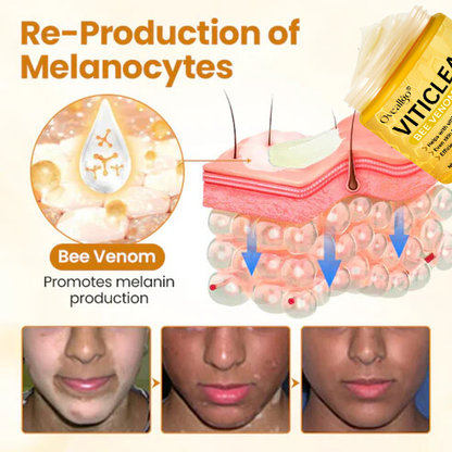 Oveallgo® VitiClear Bee Venom Cream