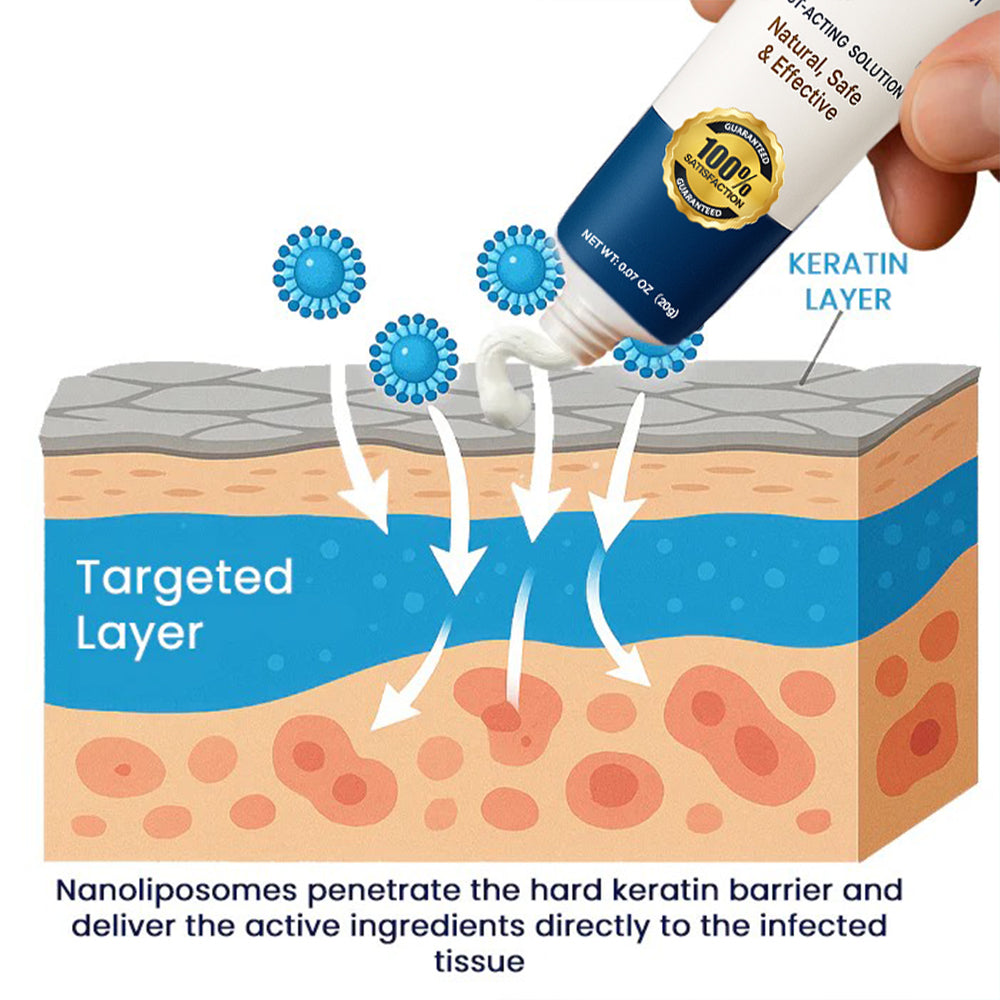 Oveallgo® Genital Warts Remover Cream 👨Designed for Men