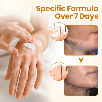 Oveallgo® Bee Venom Calm Cream