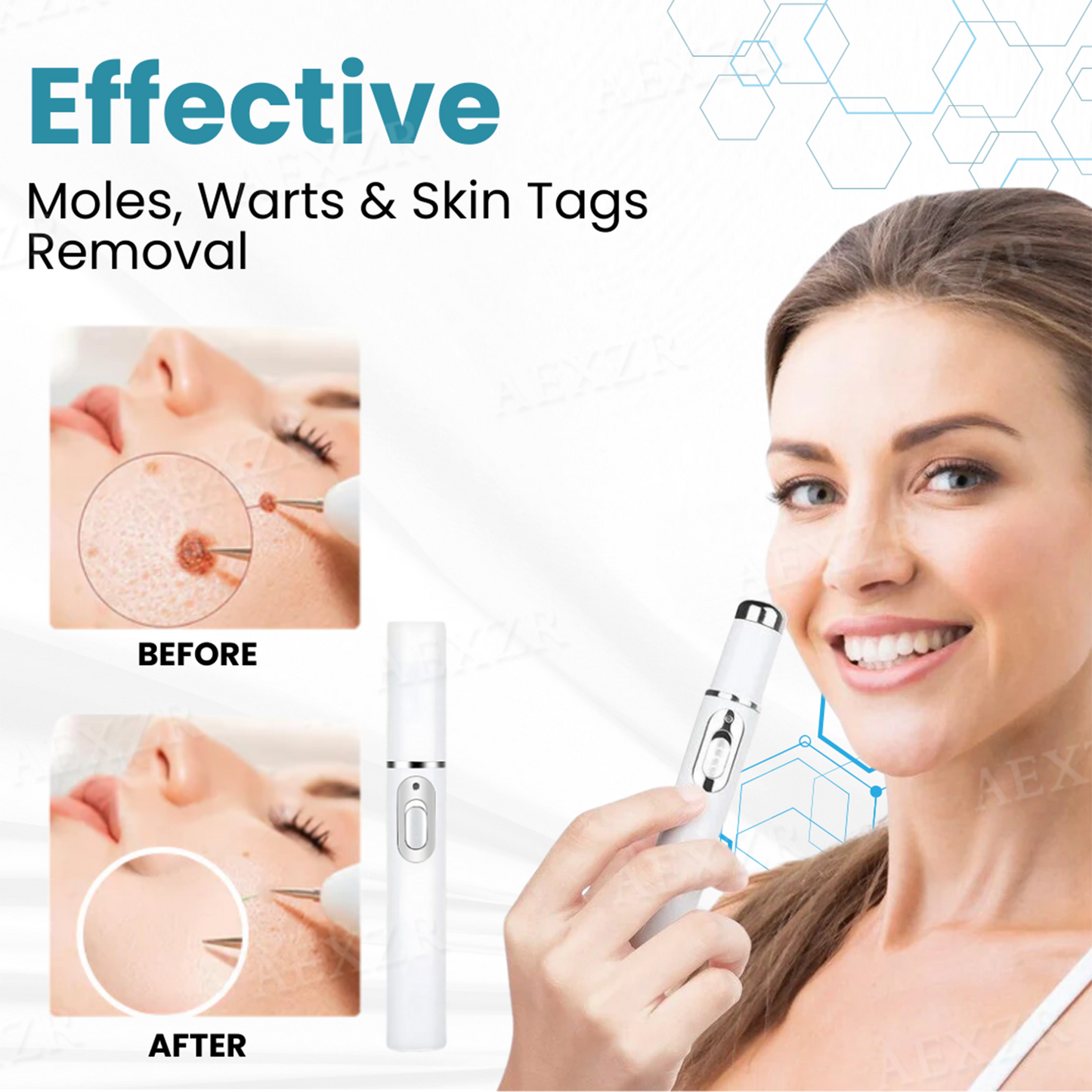 Bikenda® Non-Invasive Mole and Wart Removal Laser Pen