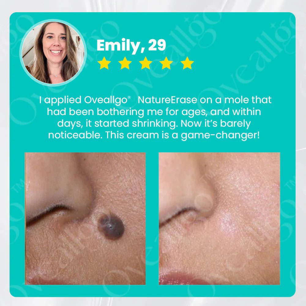 ✅ Official Store: Oveallgo® NatureErase Instant Alligator Oil Mole & Spot Removal Gel Pro