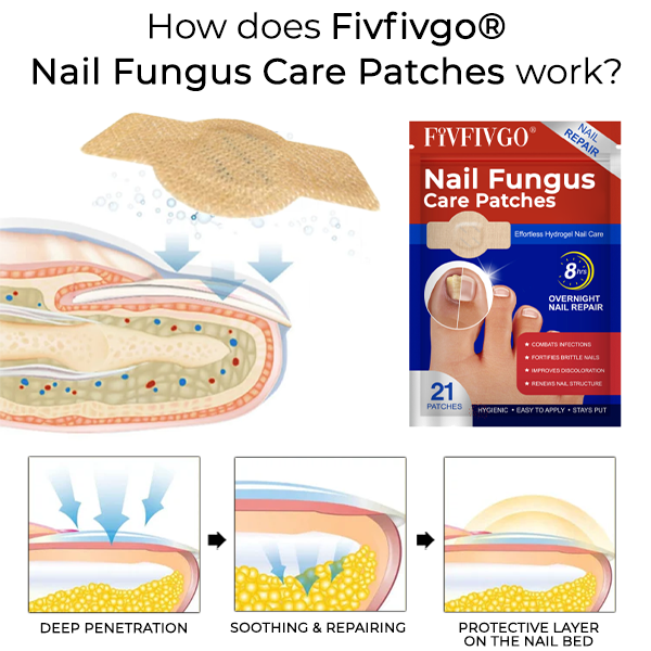 Fivfivgo® Nail Fungus Care Patches