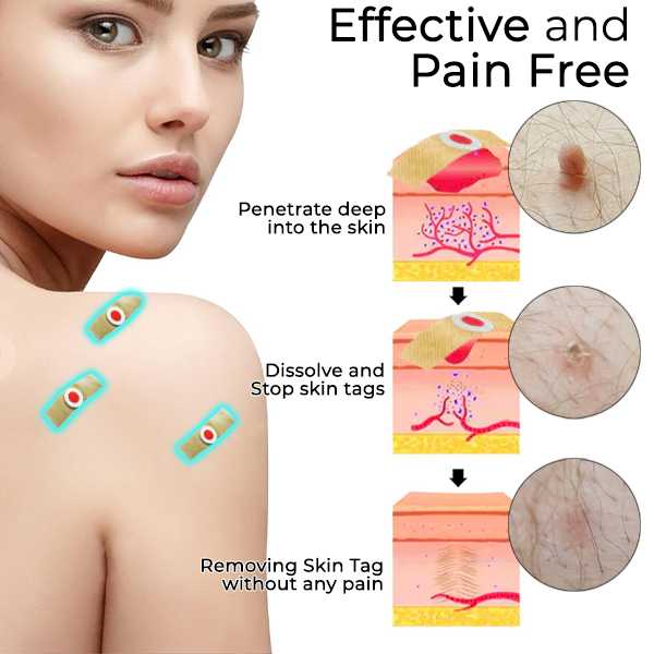 Fivfivgo® Skin Tags & Mole Aftercare Protecting Patch