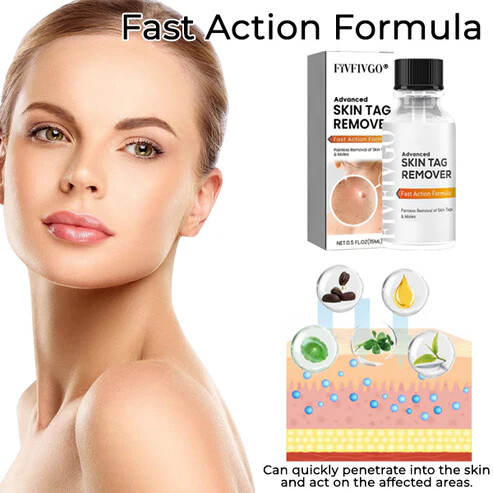 Fivfivgo® Advanced Skin Tag Remover - Fast Action Formula