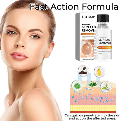 Fivfivgo® Advanced Skin Tag Remover - Fast Action Formula