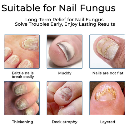 Fivfivgo® Nail Fungus Care Patches