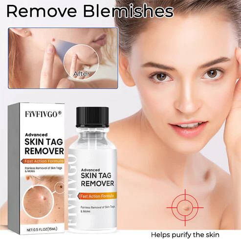Fivfivgo® Advanced Skin Tag Remover - Fast Action Formula