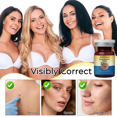 Fivfivgo® Nevus Removal Cream