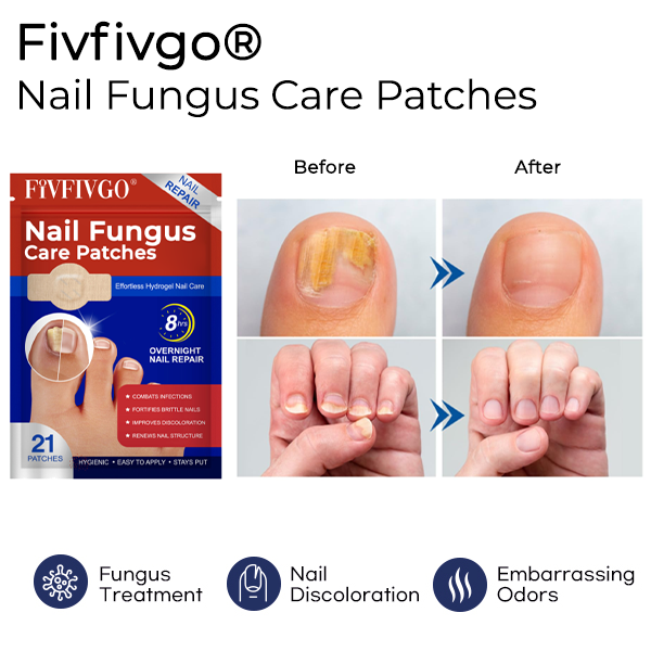 Fivfivgo® Nail Fungus Care Patches