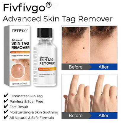 Fivfivgo® Advanced Skin Tag Remover - Fast Action Formula