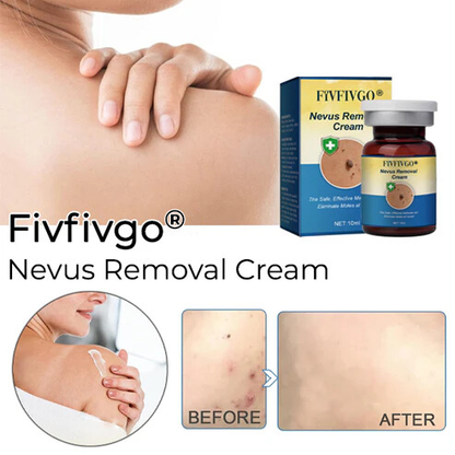 Fivfivgo® Nevus Removal Cream