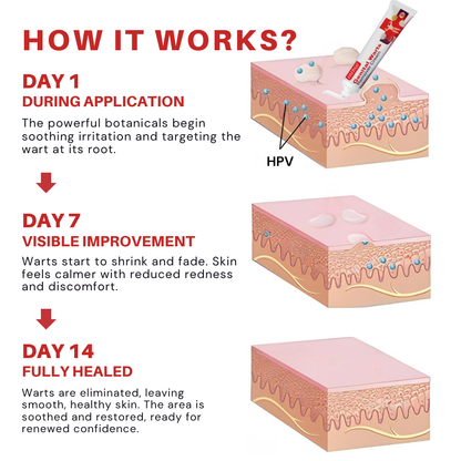 Fivfivgo® FloraGuard HPV Genital Warts Remover