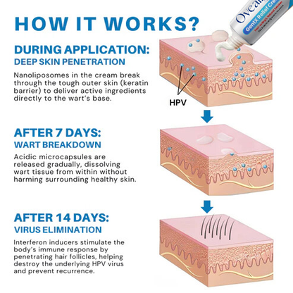 Oveallgo® HPV Genital Warts Relief Cream