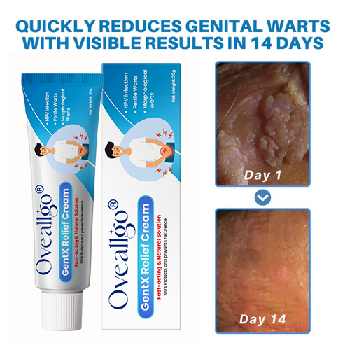 Oveallgo® HPV Genital Warts Relief Cream