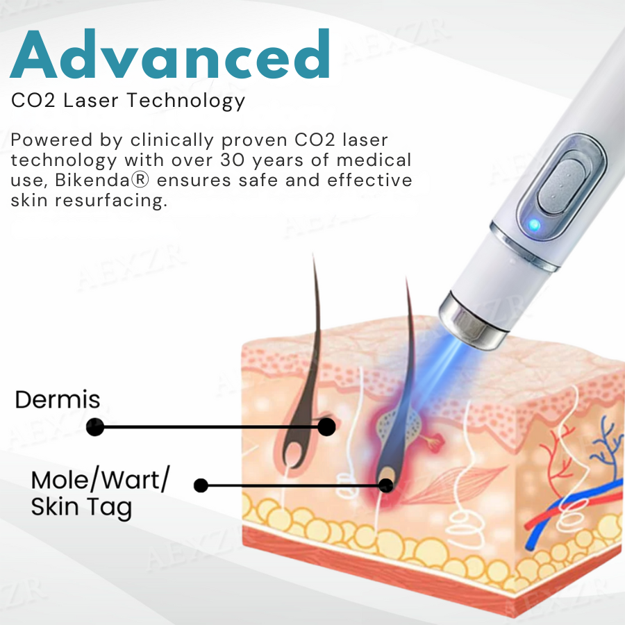 Bikenda® Non-Invasive Mole and Wart Removal Laser Pen Prox