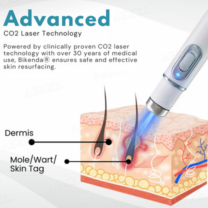 Bikenda® Non-Invasive Mole and Wart Removal Laser Pen Prox