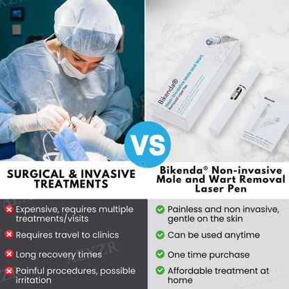 Bikenda® Non-Invasive Mole and Wart Removal Laser Pen