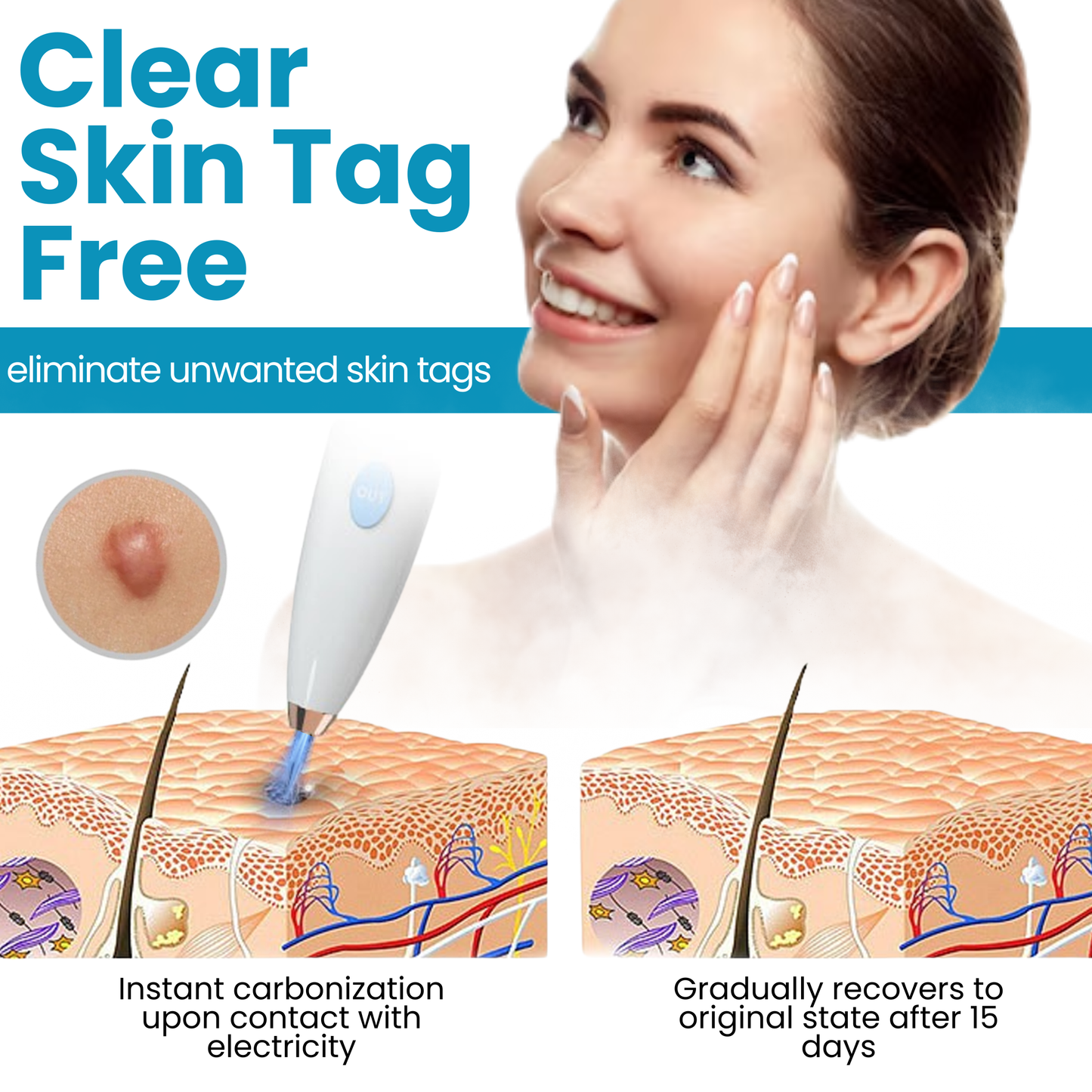 Bikenda® Home Use CO2 Laser Shot Erase Pro