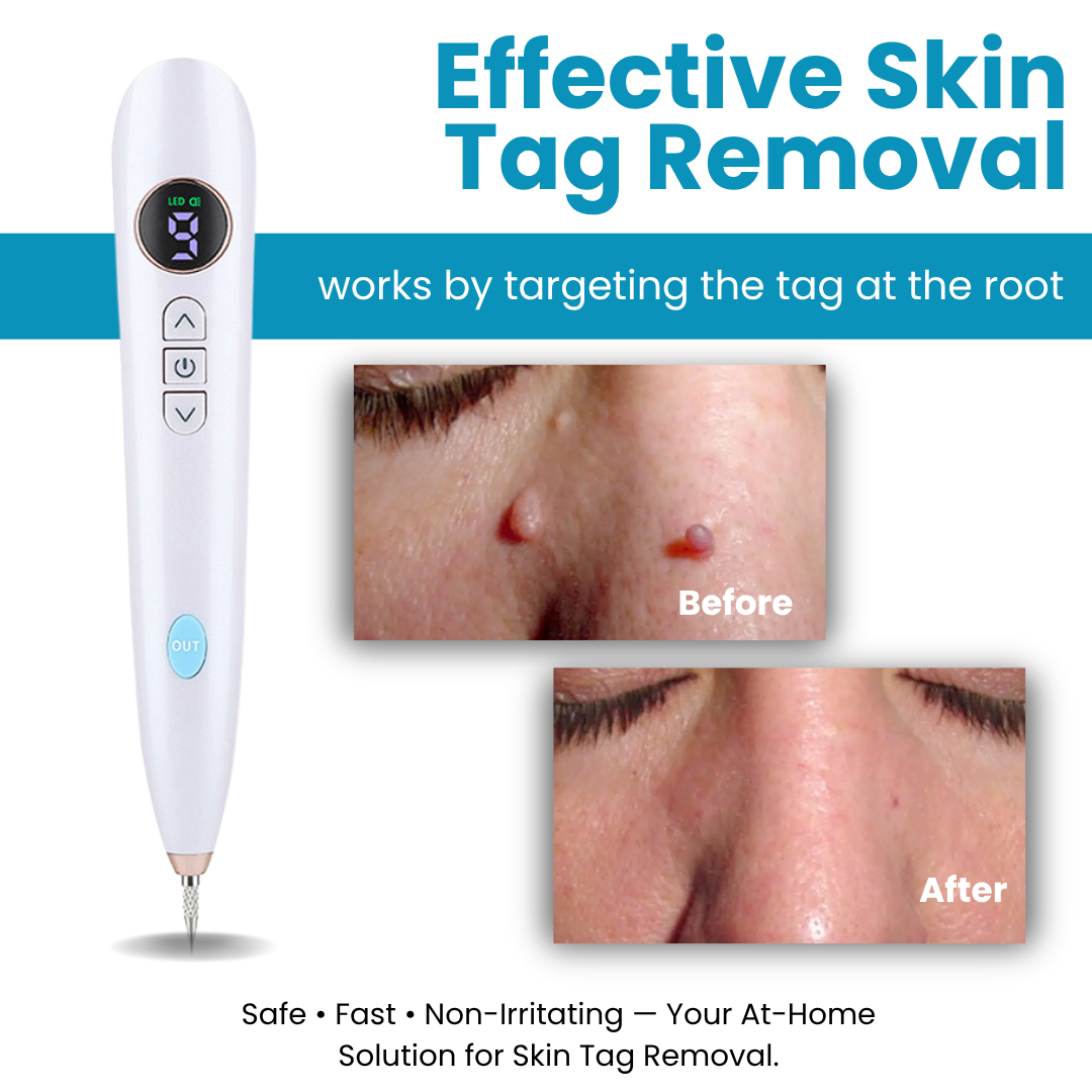 Bikenda® Home Use CO2 Laser Shot Erase Pro