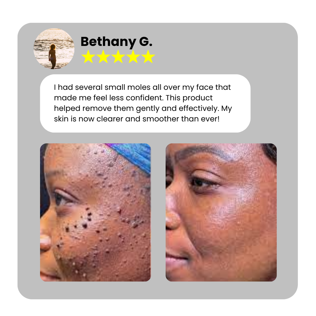 Bikenda® Home Use CO2 Laser Shot Erase Pro