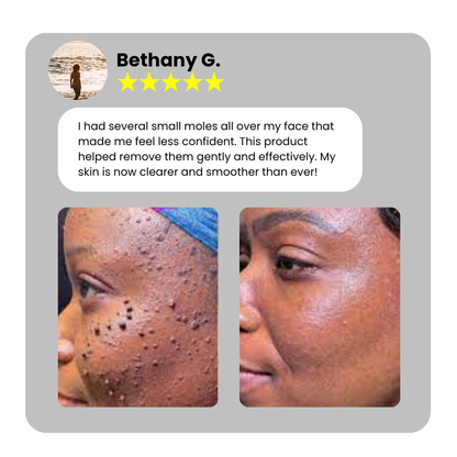 Bikenda® Home Use CO2 Laser Shot Erase Pro