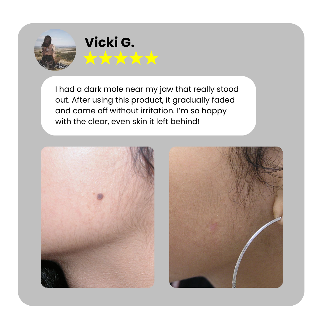 Bikenda® Home Use CO2 Laser Shot Erase Pro